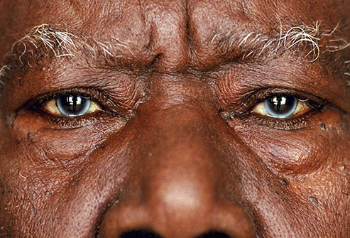olhos multicoloridos