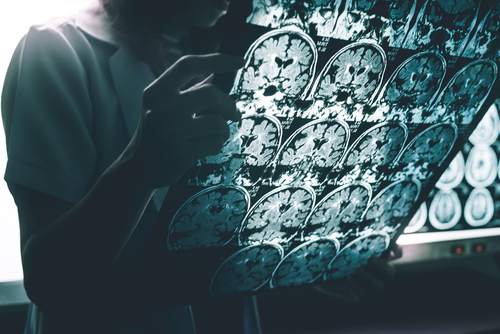 raiox cerebro